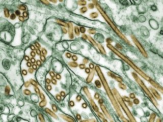 H5N1 bird flu viruses show up in gold, they have infected a cell culture made of canine kidney cells, shown in green. Scientists and public health officials fear H5N1 could one day cause a flu pandemic, just as H1N1 did in 1918. 