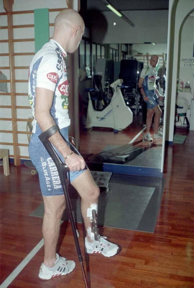 Coming back from injury in 1995