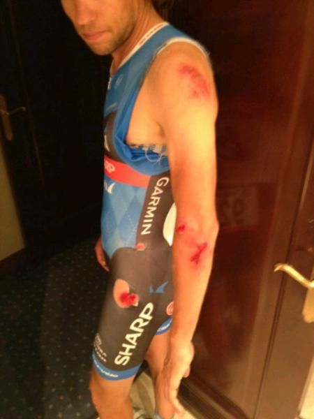 Thomas Dekker (Garmin-Sharp) shows off his injuries from the stage one crash