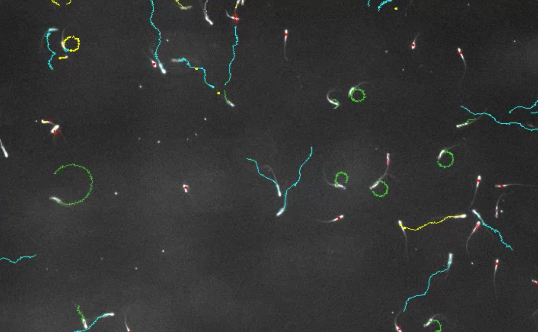 T-haplotype sperm (blue trails) can poison and disable their competitors (green trails), forcing them to swim in circles.