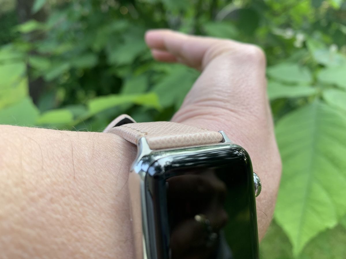 CASETiFY Apple Watch Band