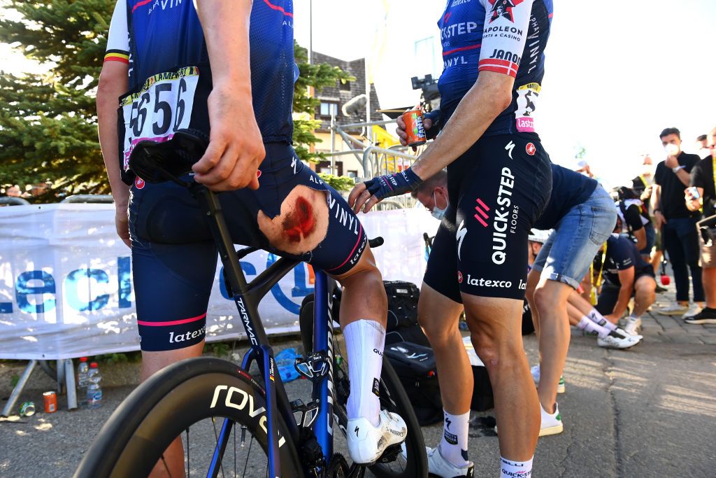 ALPE DHUEZ FRANCE JULY 14 Yves Lampaert of Belgium and QuickStep Alpha Vinyl Team injuries after the 109th Tour de France 2022 Stage 12 a 1651km stage from Brianon to LAlpe dHuez 1471m TDF2022 WorldTour on July 14 2022 in Alpe dHuez France Photo by Tim de WaeleGetty Images