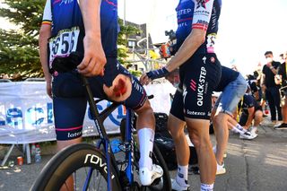 ALPE DHUEZ FRANCE JULY 14 Yves Lampaert of Belgium and QuickStep Alpha Vinyl Team injuries after the 109th Tour de France 2022 Stage 12 a 1651km stage from Brianon to LAlpe dHuez 1471m TDF2022 WorldTour on July 14 2022 in Alpe dHuez France Photo by Tim de WaeleGetty Images