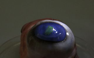A new laser membrane is flexible enough to attach to a contact lens and be placed on a cow's eye.