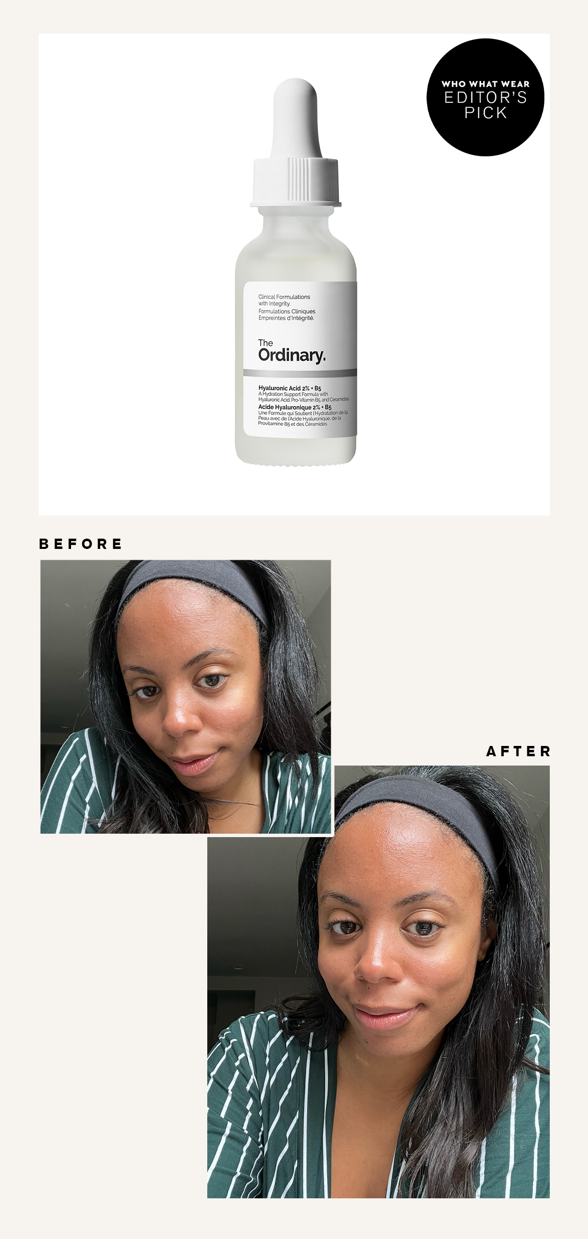 The Ordinary Hyaluronic Acid Serum: Before and After Picture