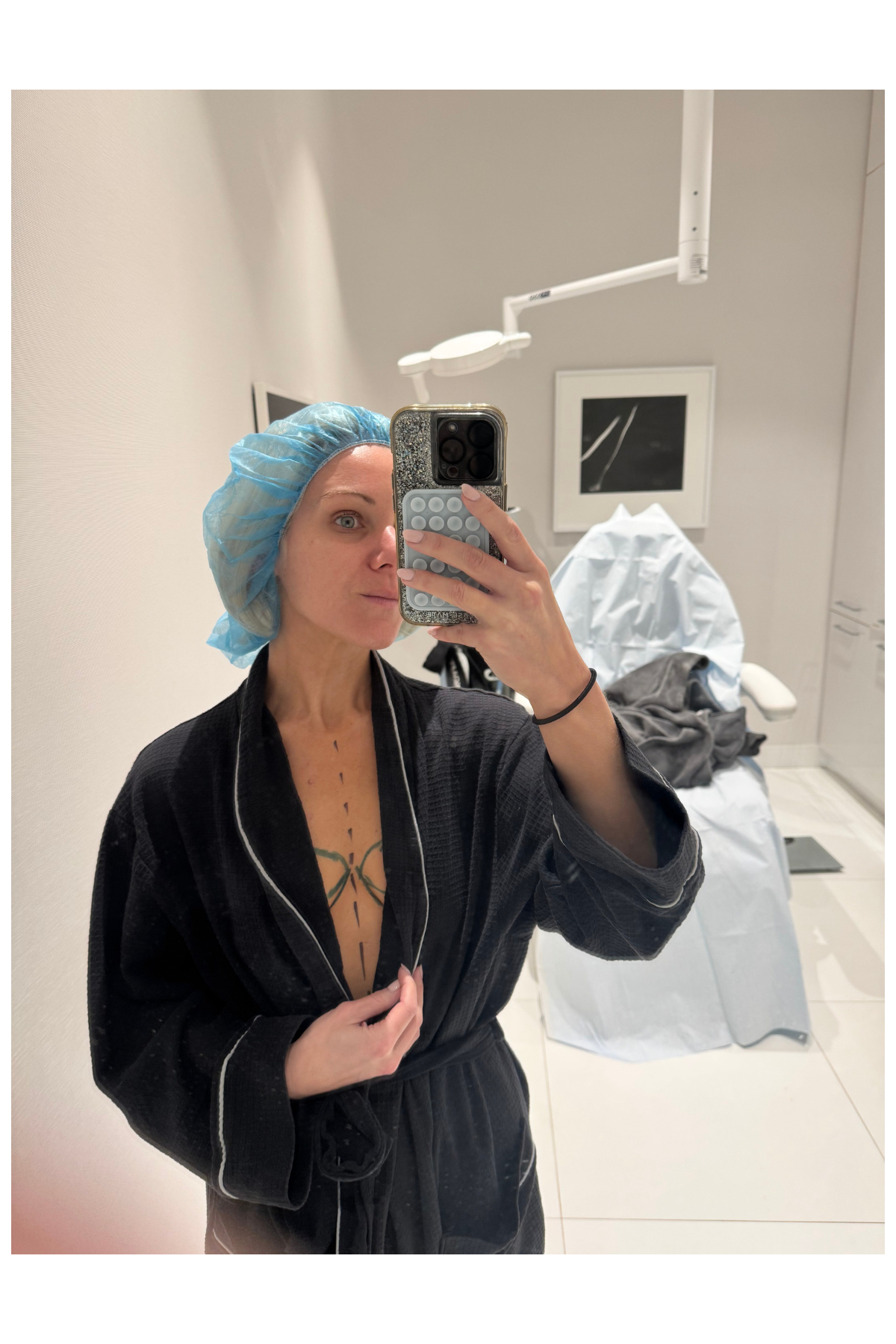 Micaela English in a robe with markings on her chest pre-surgery