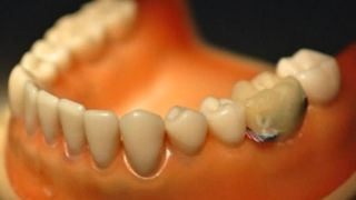 Smart tooth tech is just what the doctor ordered