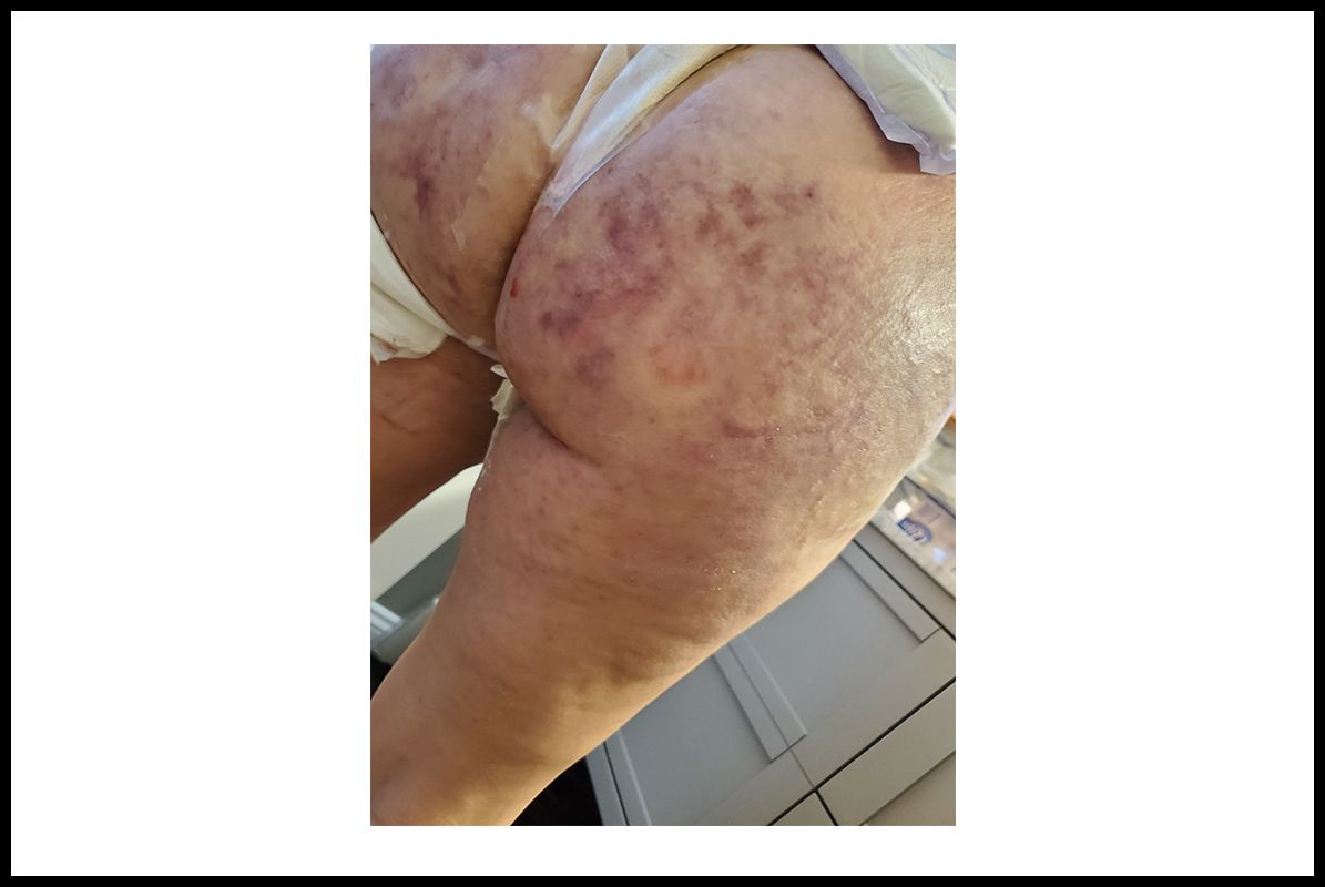 Photos from Goals patients