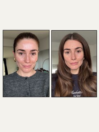 Before and after using the currentbody LED mask series 2