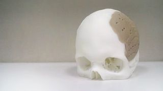 3D skull