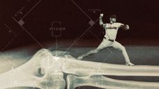 Photo collage of Shane Bieber of the Cleveland Guardians pitching a ball standing on a giant x-ray image of an elbow. Vintage baseball field diagrams overlay the image.