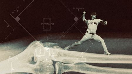 Photo collage of Shane Bieber of the Cleveland Guardians pitching a ball standing on a giant x-ray image of an elbow. Vintage baseball field diagrams overlay the image.