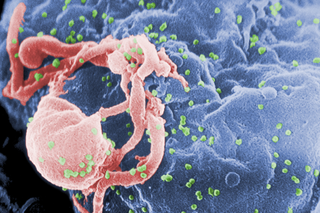 The HIV-1 virus infects a lymphocyte, or white blood cell.