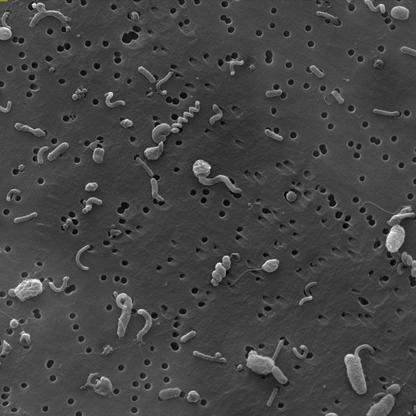 Marine Bacterial Community. An electron microscope image of a bacterial community, on a filter. These microbes were collected 820 feet (250 meters) below the Sargasso Sea near Bermuda. 