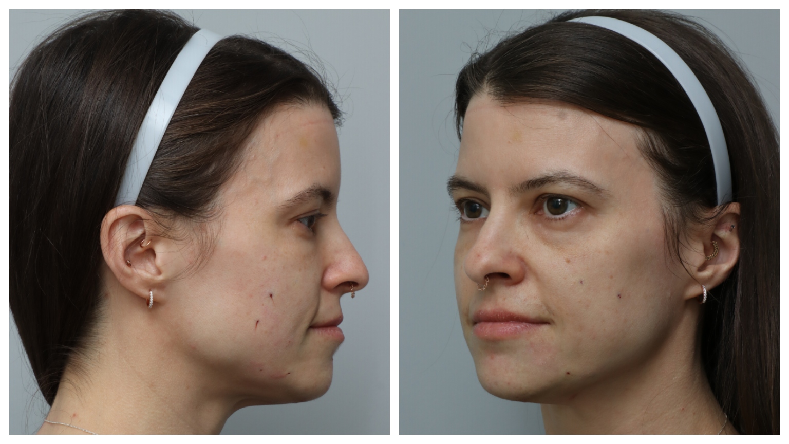 two side by side photos of a white woman with bare skin, brown eyes, and brown hair