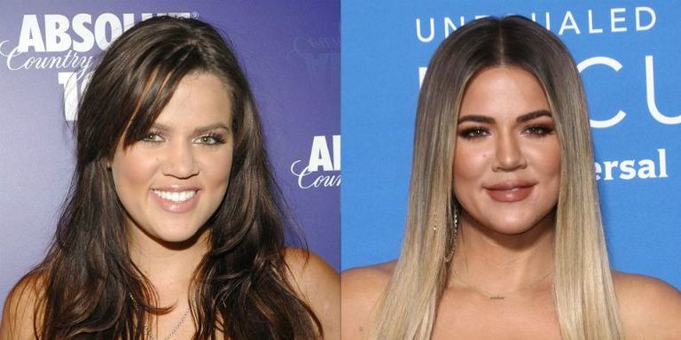 Khloe Kardashian BEFORE & AFTER 32 YEAR TIME LAPSE - YouTube