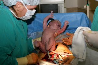 C Section Procedure Recovery Live Science