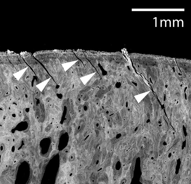 A scanning electron microscopic image of the fetlock joint surface of a Thoroughbred racehorse in race training showing the typical oblique cracks we see (arrow heads) due to fatigue damage. The line in the upper right is the scale of the image.