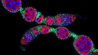 an image of fly ovarioles