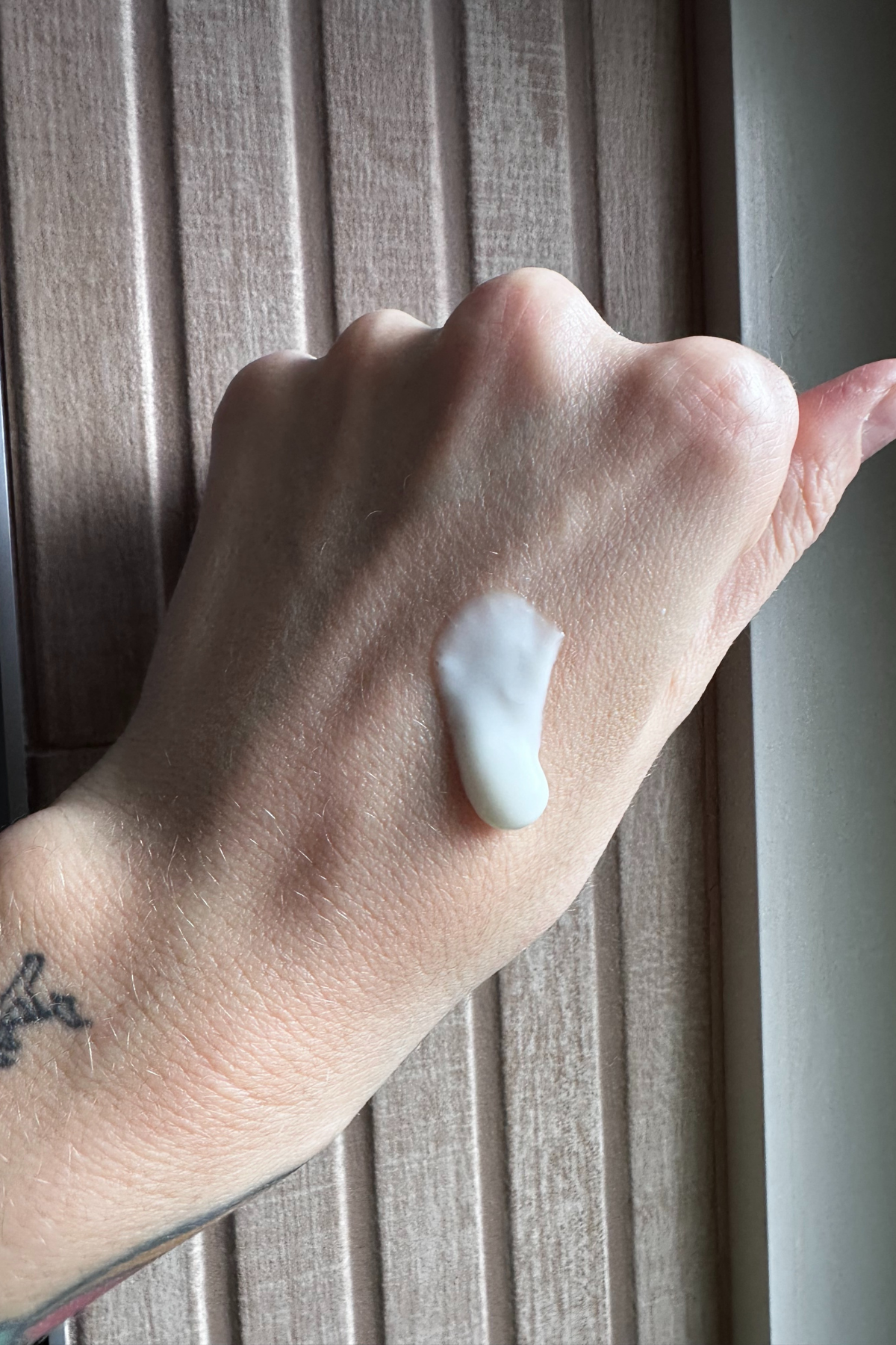 Hannah Baxter's hand with skinfix serum on the back