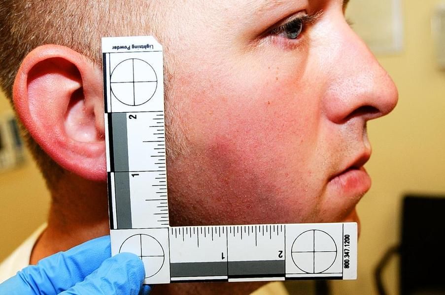 Photos of Darren Wilson&amp;#039;s injuries released