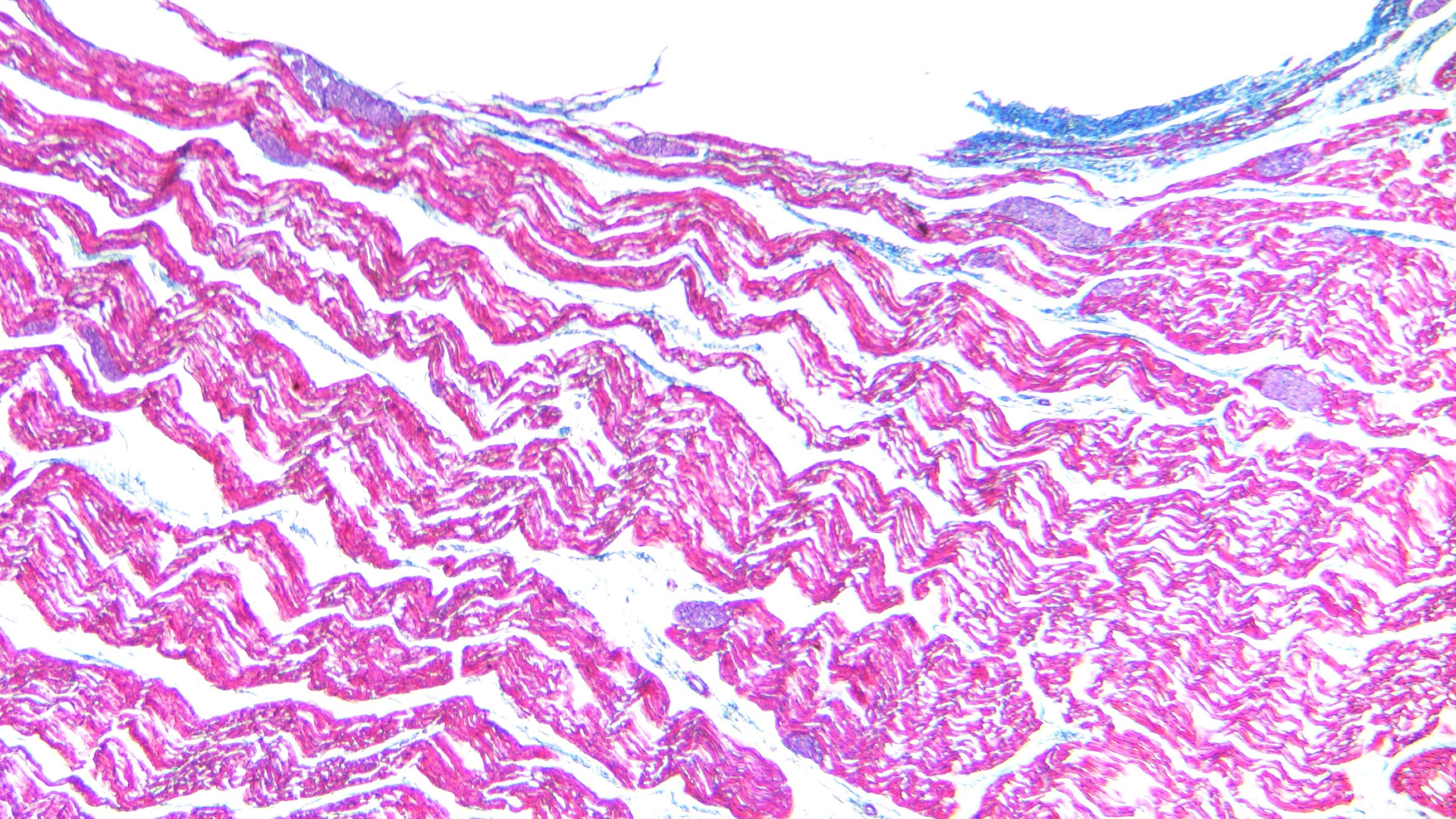 A photo of the parasite Sarcocystis, which causes a disease in humans with no proven treatment.