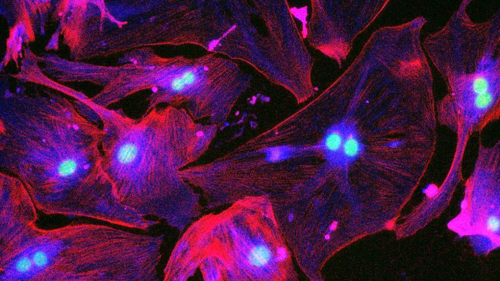 microscopy image shows senescent cells with membranes shown in glowing pink and nuclei marked in light blue; many cells have two or more nuclei 