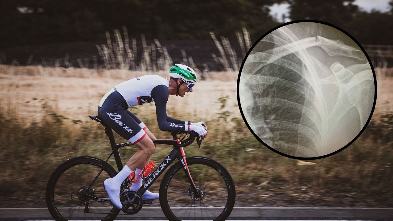 Image of Adam Jones time trialling, with collarbone break xray