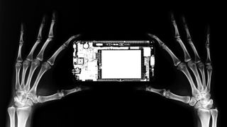 x-ray of hands holding a cell phone