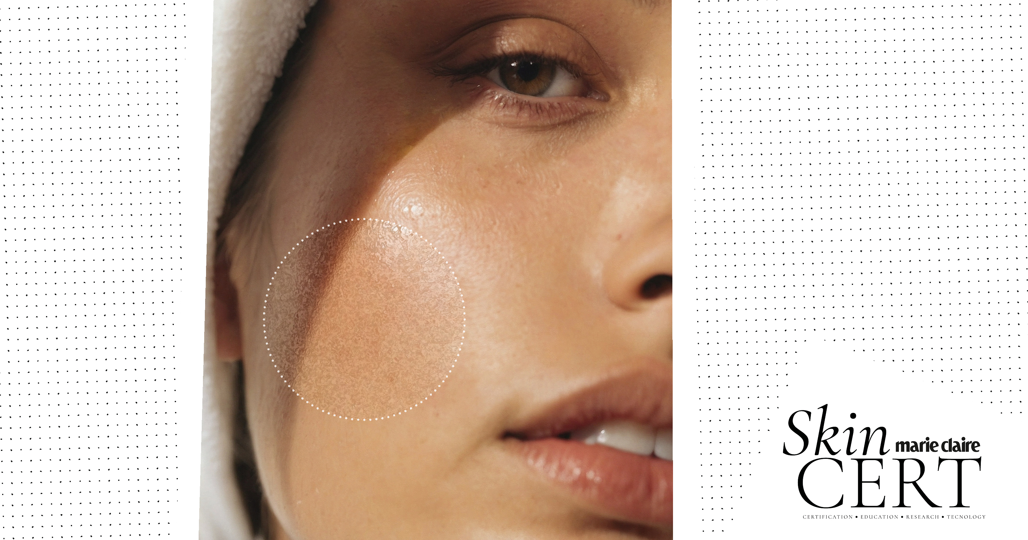 How does alcohol affect the skin