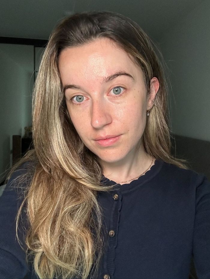 Genç güzellik editörü Grace Lindsay, Mimetique cilt bakımını denedikten sonra selfie çekiyor