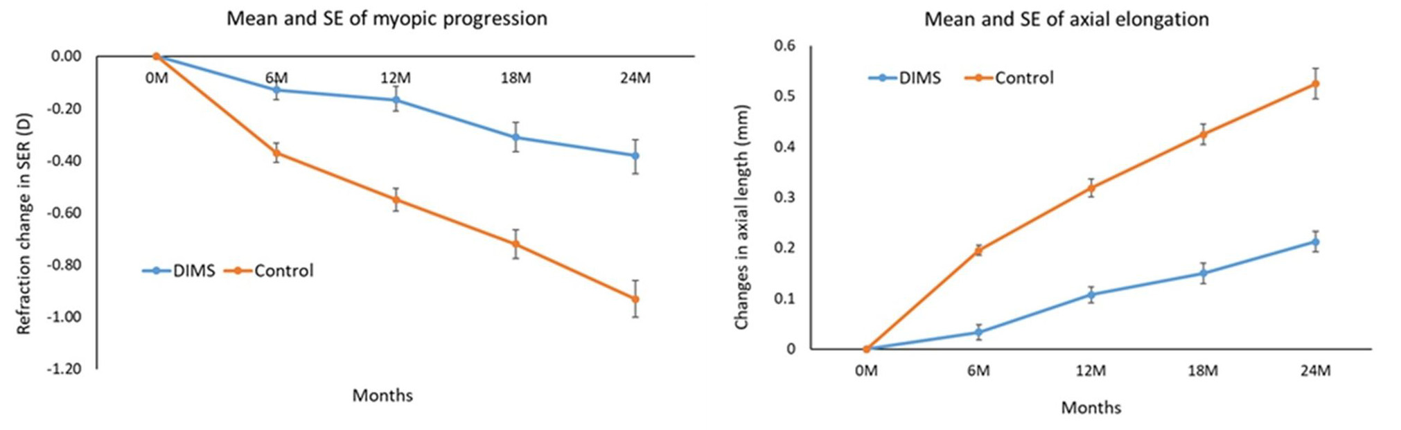 A chart showing the effectiveness of DIMS lenses in slowing progression of childhood myopia