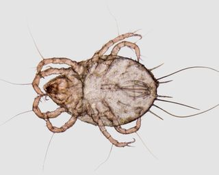 An image of a dust mite under a microscope