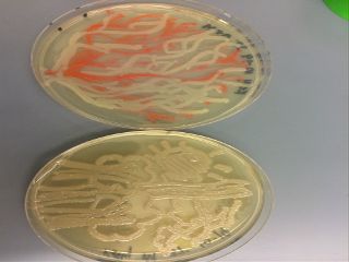 After a few days the bacteria grew and made the artwork visible.