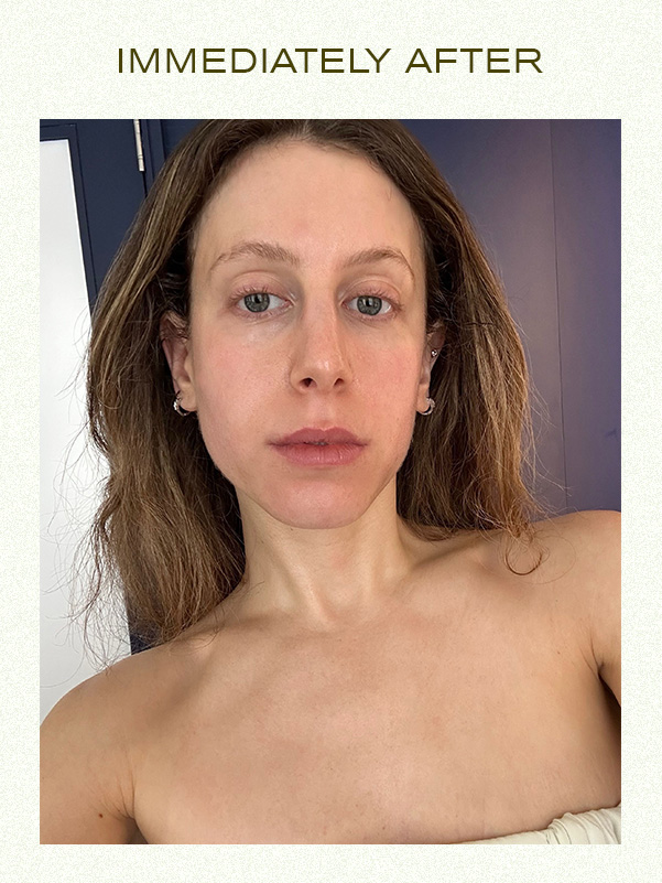 Jamie Schneider immediately after Lord Gavin's signature red carpet facial