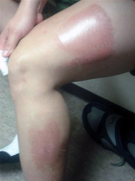 The results of a crash
