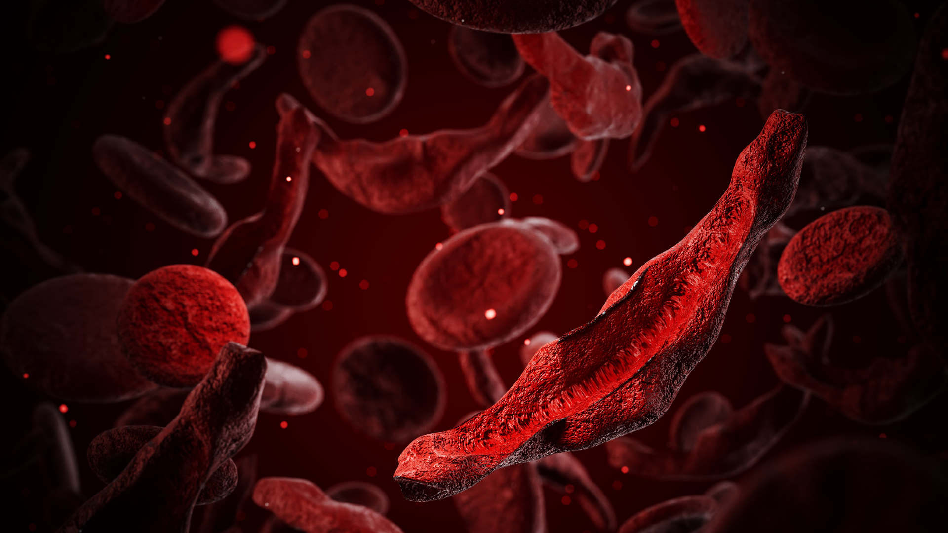 An illustration of the inside of a blood vessel, showing healthy donut shaped cells and sickle-shaped blood cells