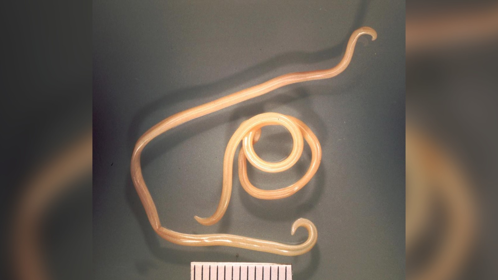 A photo of the roundworm that causes the parasitic infection Toxocariasis.
