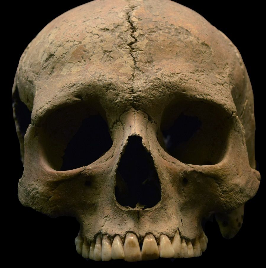 Scientists examined DNA from tooth pulp from skeletal remains found in three Italian cemeteries, including this skull from Velia, considered an important port city and trading center. 