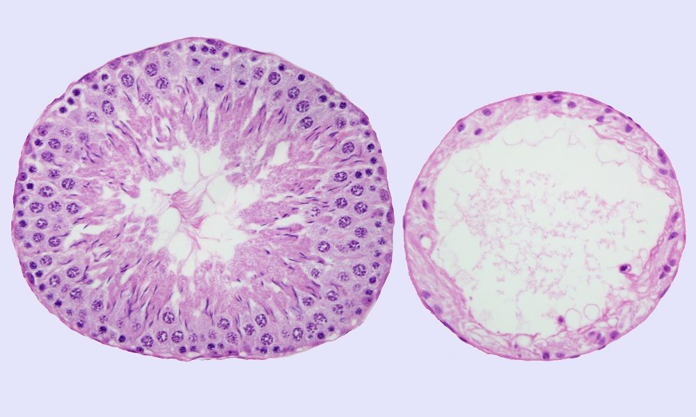 Treated seminiferous tubules