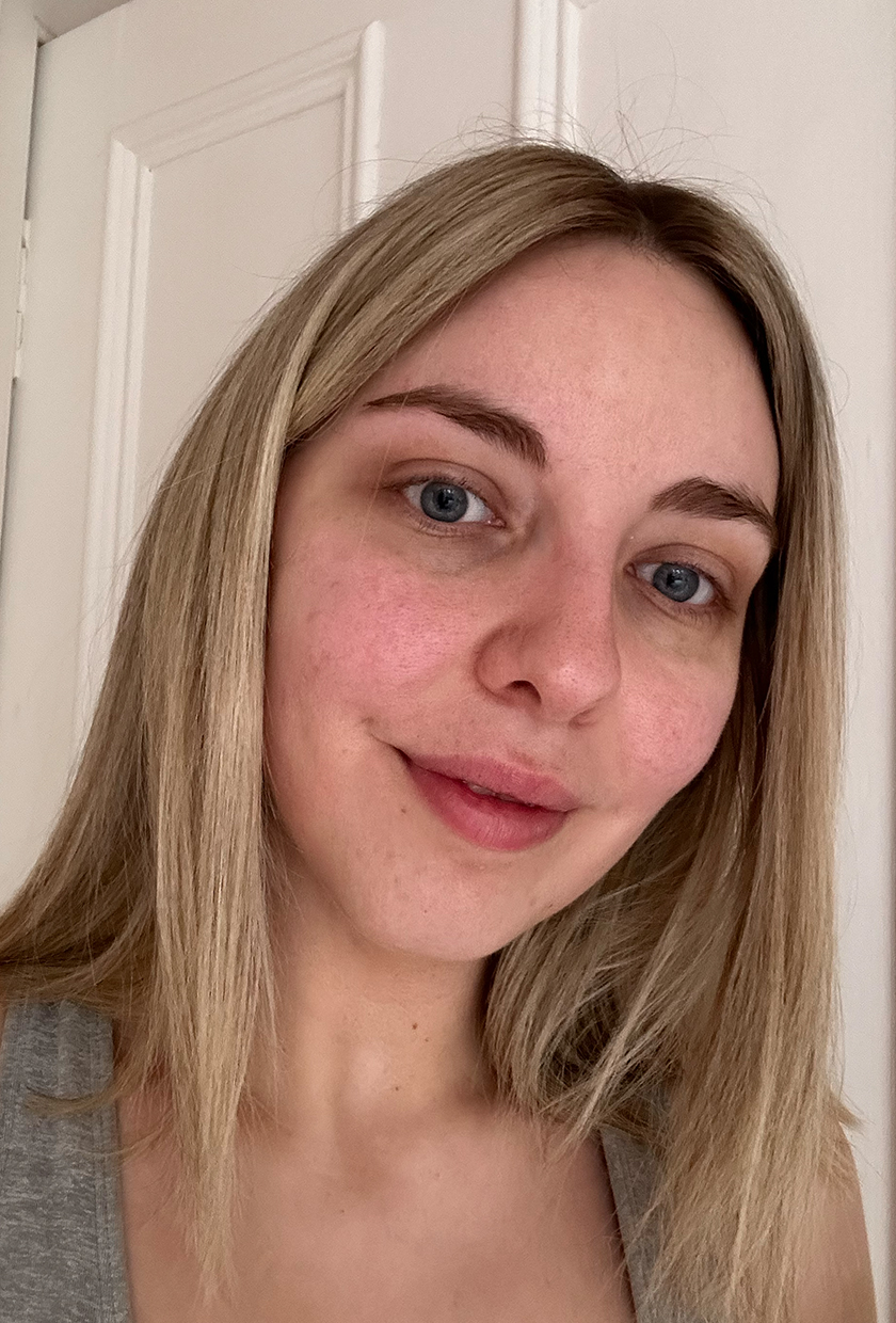 After using MZ Skin LED Mask