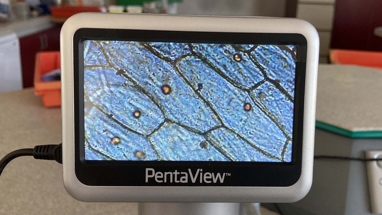 onion epidermis on a microscope screen