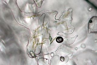 Sea ice algae, arctic
