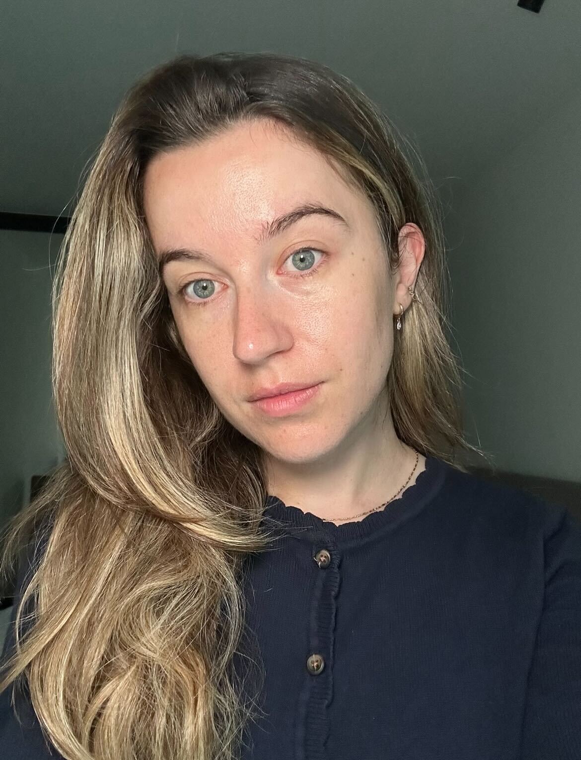 Grace Lindsay before using Beauty Pie Dynamo LED Mask