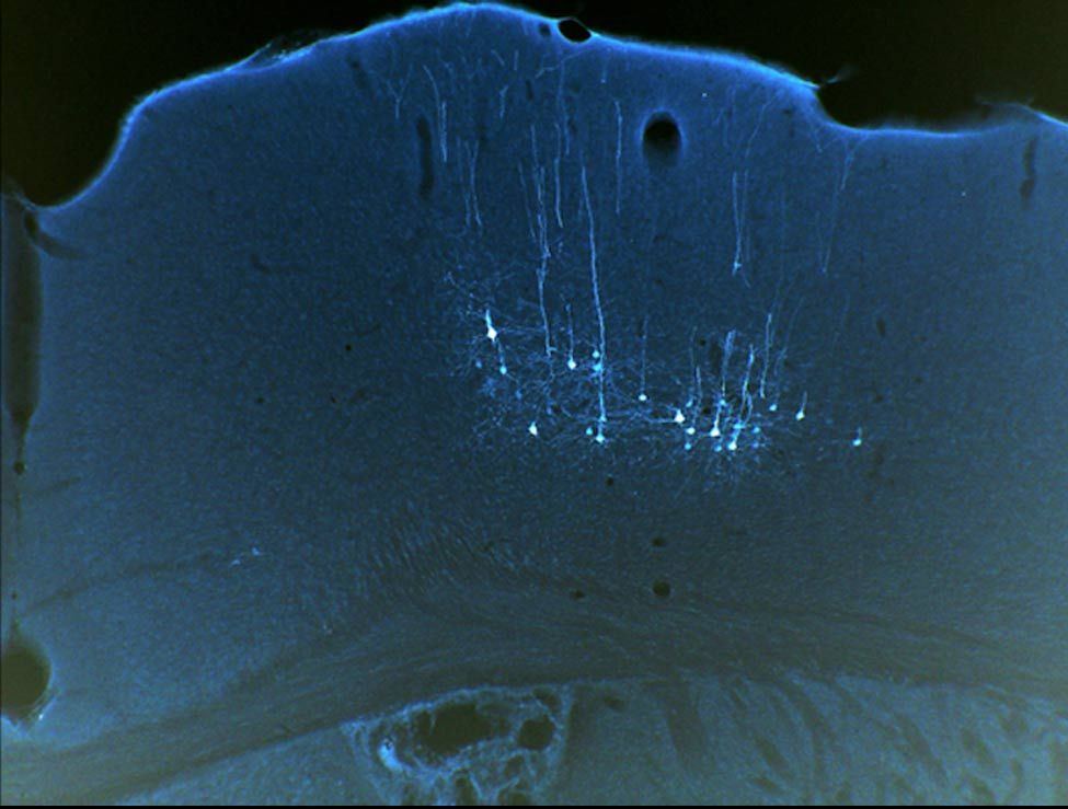 motor cortex neurons in male mice