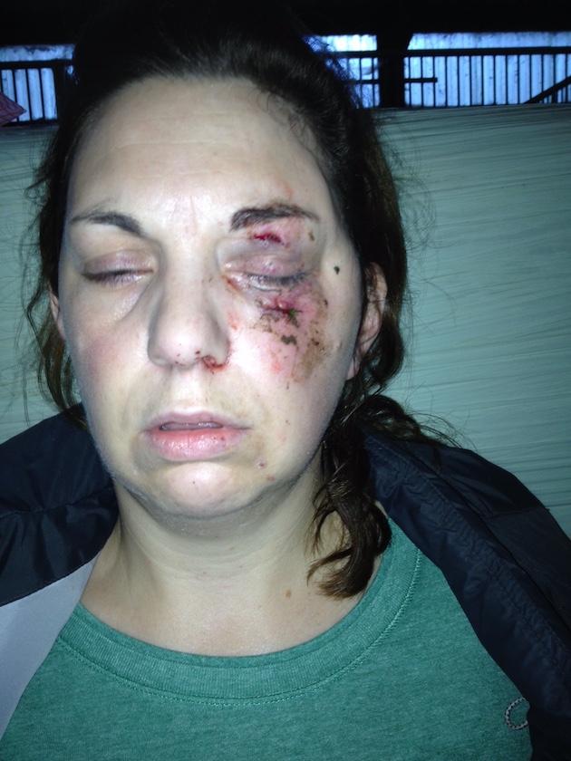 Sally-Morris-before.jpg