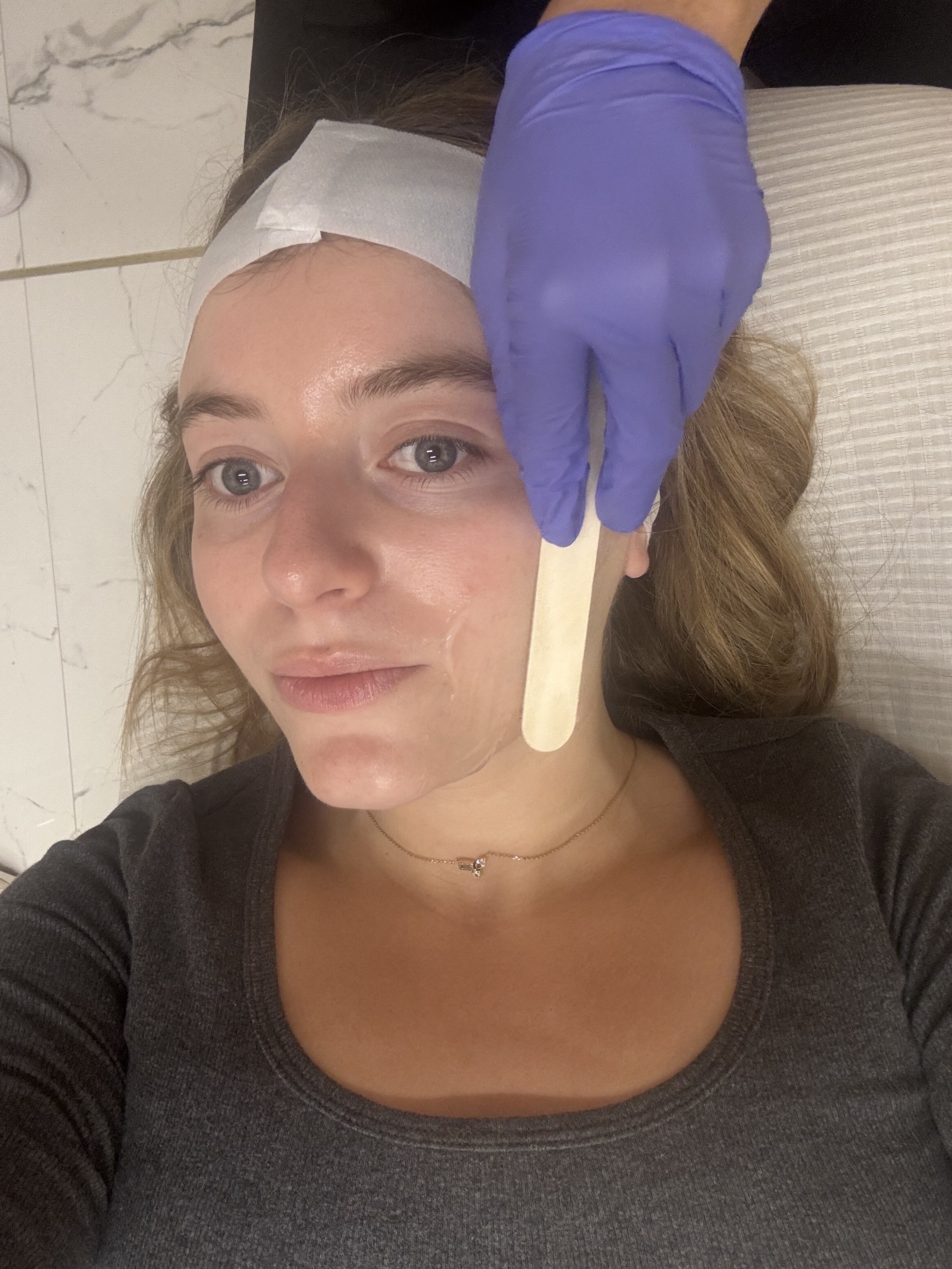 Samantha Holender having conductive gel spread on her skin before a Sofwave treatment.