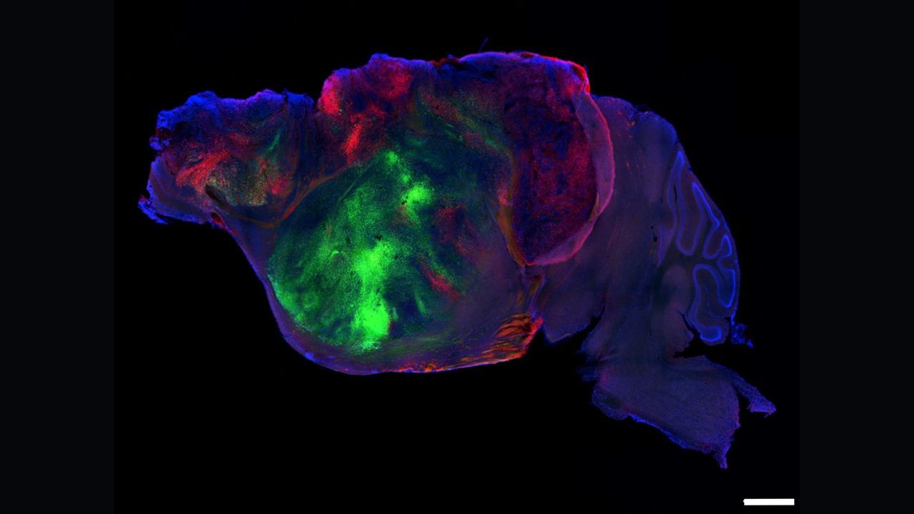 Scientists shrank mice's brains and replaced the missing tissue with human 'organoids'