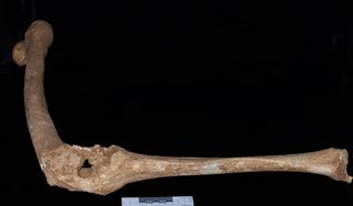 The left leg of an adult male skeleton found in Tomb I at Vergina. The thigh bone (femur) and one of the bones of the lower leg (the tibia) are fused, and hole at the knee suggests a devastating penetrating injury.