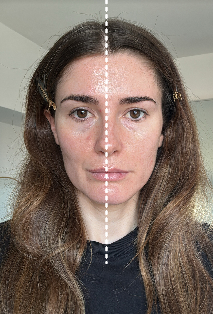 A side by side comparison of using the NuFace Trinity device on one half of the face, which is visibly more lifted and sculpted compared to the other side